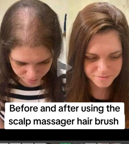 Massageador Elétrico para Couro Cabeludo e estimulador capilar Amaia Beleza