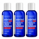Skintrat 120ml – Solução Antifoliculite e Pelos Encravados