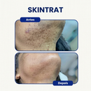 Skintrat 120ml – Solução Antifoliculite e Pelos Encravados
