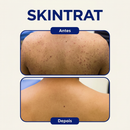 Skintrat 120ml – Solução Antifoliculite e Pelos Encravados