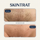 Skintrat 120ml – Solução Antifoliculite e Pelos Encravados